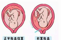 三代试管婴儿报销费用是多少？三代试管婴儿有什么优惠政策吗？
