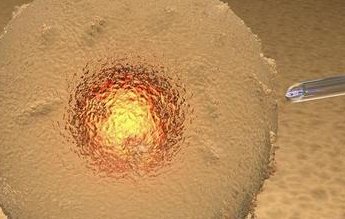 山东人工授精技术好的医院应该怎样找？